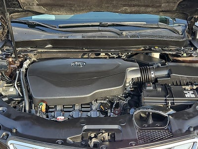 2015 Acura TLX V6 Advance